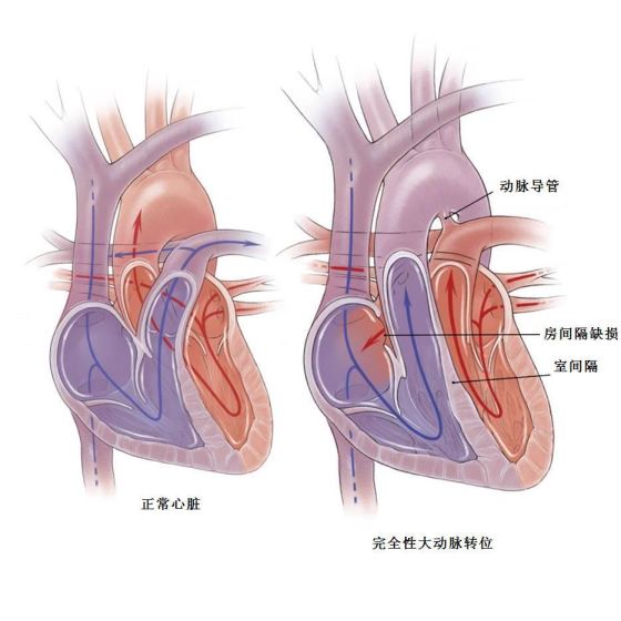 右心室人口_右心室肥大心电图(2)