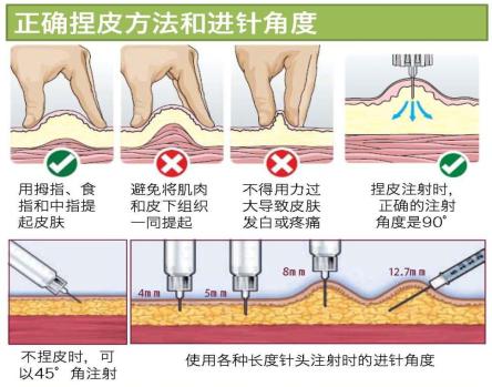 选择腹部注射胰岛素时,均需捏皮并避开肚脐周围.   9.