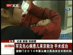 北京电视台BTV北京卫视频道“特别关注”：罕见先心病患儿来京救治，手术成功