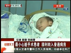 北京电视台：特别关注：最小心脏手术患者，顺利转入普通病房