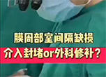 膜周部室间隔缺损 介入封堵or外科修补？