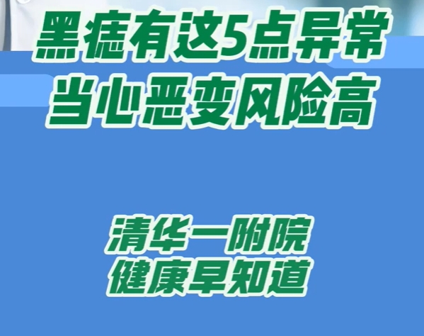 黑痣有这5点异常当心恶变风险高